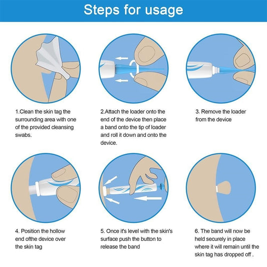 Skin Tag Remover Kit
